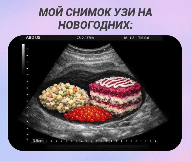 На экране УЗИ-аппарата вместо плода видны оливье, красная икра и селедка под шубой.