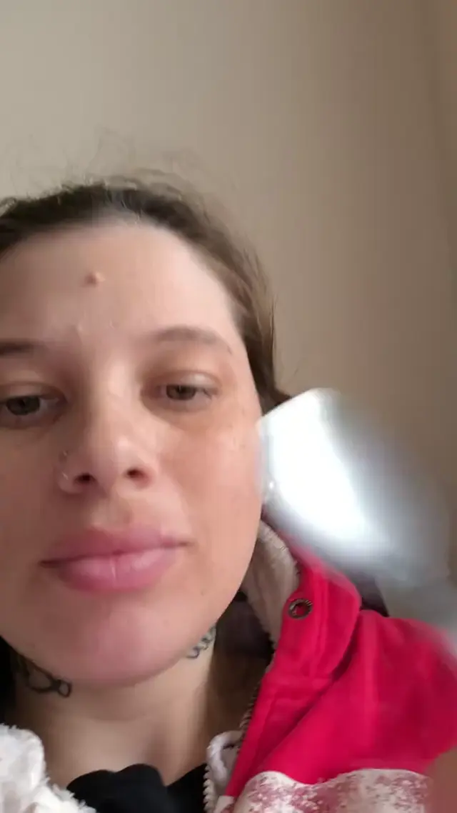 Снятие брекетов ложкой