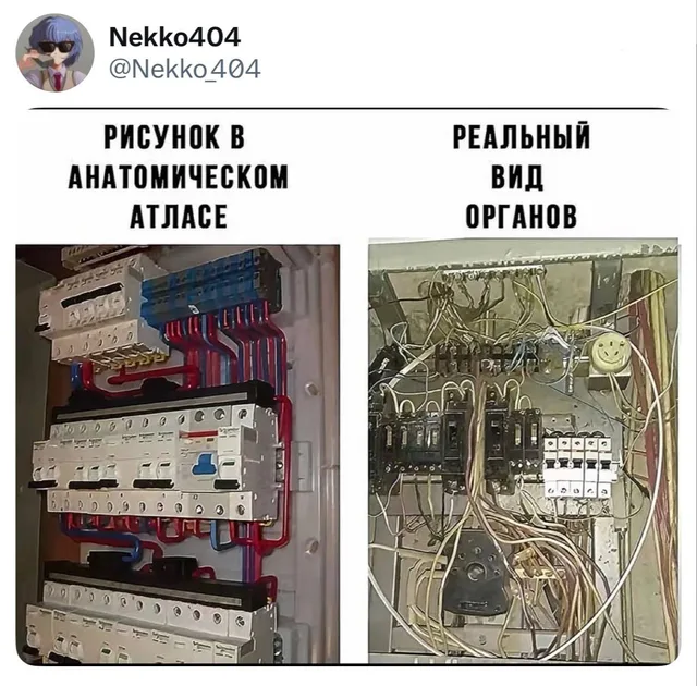 Рисунок в анатомическом атласе vs Реальный вид органов